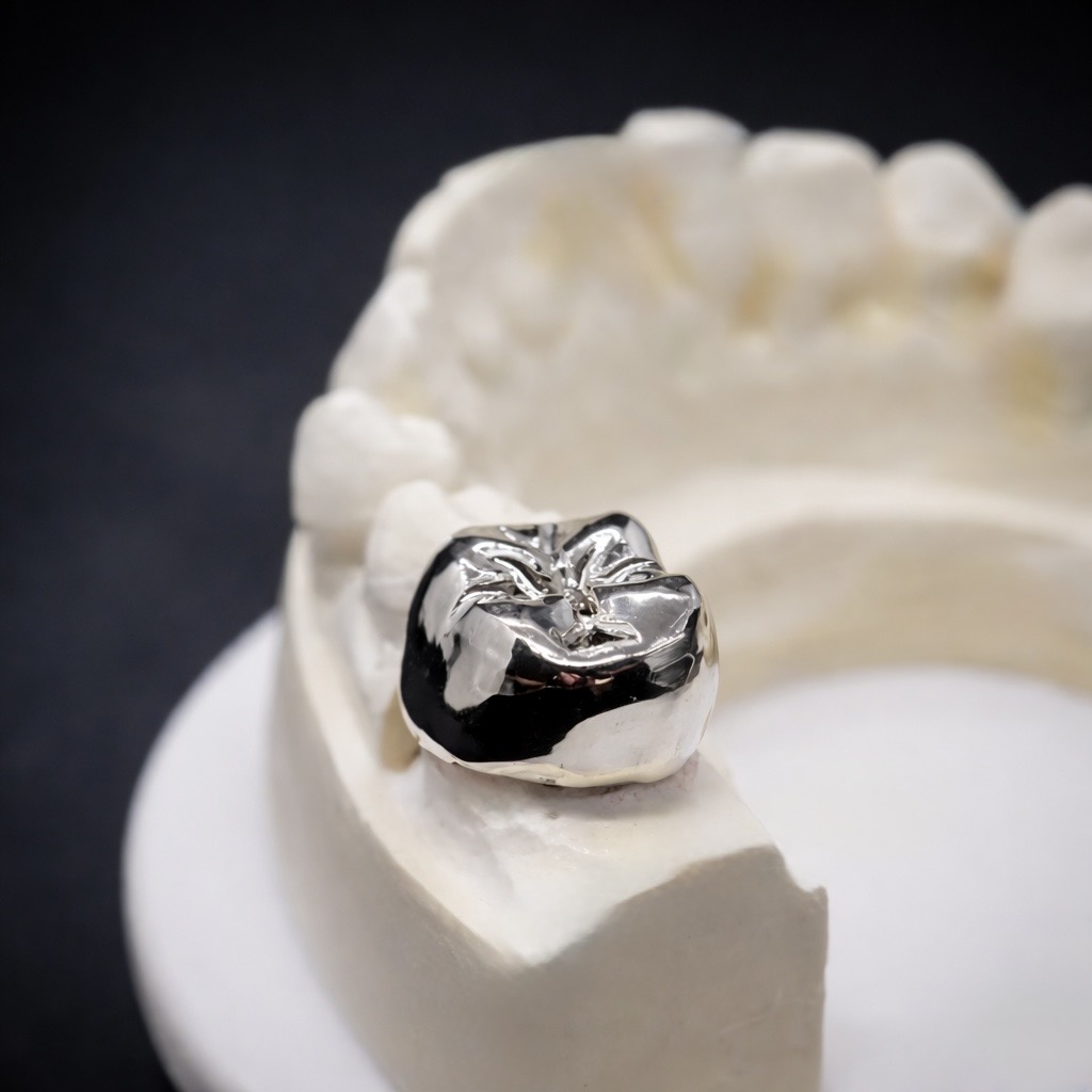 Polished metal crown seated on stone model