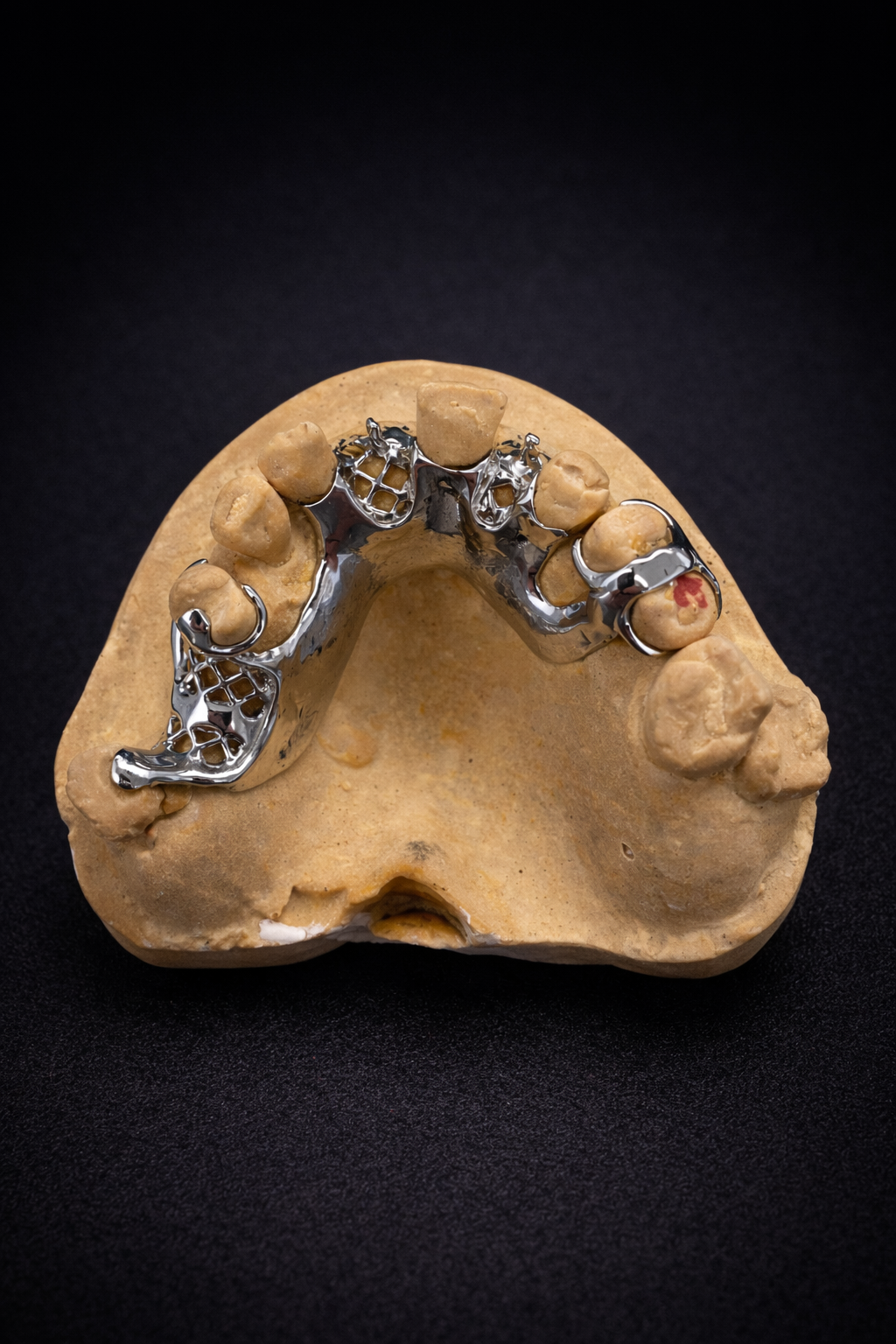 Precision mesh partial framework on stone model
